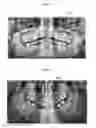 Fig. 04 - APPARATUS AND METHOD FOR ANALYZING RADIOGRAPHY POSITION ERROR OR RADIOGRAPHY CONDITION ERROR OR BOTH BASED ON X-RAY RADIOGRAPH