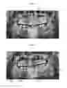 Fig. 05 - APPARATUS AND METHOD FOR ANALYZING RADIOGRAPHY POSITION ERROR OR RADIOGRAPHY CONDITION ERROR OR BOTH BASED ON X-RAY RADIOGRAPH