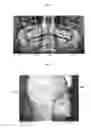 Fig. 06 - APPARATUS AND METHOD FOR ANALYZING RADIOGRAPHY POSITION ERROR OR RADIOGRAPHY CONDITION ERROR OR BOTH BASED ON X-RAY RADIOGRAPH