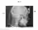 Fig. 07 - APPARATUS AND METHOD FOR ANALYZING RADIOGRAPHY POSITION ERROR OR RADIOGRAPHY CONDITION ERROR OR BOTH BASED ON X-RAY RADIOGRAPH