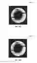Fig. 16 - Bet sensing apparatuses and methods