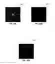 Fig. 35 - Bet sensing apparatuses and methods