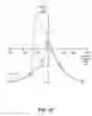 Fig. 13 - Coupled soft bias scissor type sensor