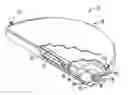 Fig. 01 - Methods of manufacturing a hermetically sealed wet electrolytic capacitor and a hermetically sealed wet electrolytic capacitor
