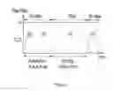 Fig. 02 - High aspect ratio patterning of hard mask materials by organic soft masks