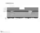 Fig. 04 - SELF ALIGNED CONTACTS FOR SOLAR CELLS