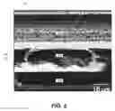 Fig. 08 - Bonding using conductive particles in conducting adhesives