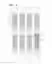 Fig. 15 - Organic light emitting display device with improved sub-pixel structure for repair and repairing method of the same