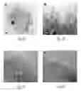 Fig. 06 - POROUS SILICON ELECTRODE AND METHOD