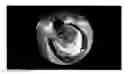 Fig. 01 - DYNAMIC FIELD OF VIEW ADJUSTMENT FOR PANORAMIC VIDEO CONTENT USING EYE TRACKER APPARATUS
