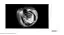 Fig. 05 - DYNAMIC FIELD OF VIEW ADJUSTMENT FOR PANORAMIC VIDEO CONTENT USING EYE TRACKER APPARATUS