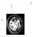 Fig. 04 - DYNAMIC ADJUSTMENT OF EXPOSURE IN PANORAMIC VIDEO CONTENT