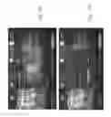 Fig. 15 - Systems and methods automatically erasing content stored on a set top box