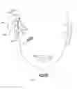 Fig. 01 - Head-wearable hearing device