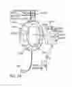 Fig. 07 - INTELLIGENT 3D EARPHONE