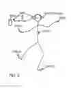 Fig. 16 - INTELLIGENT 3D EARPHONE