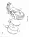 Fig. 19 - Damping in contact hearing systems