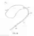 Fig. 30 - Damping in contact hearing systems