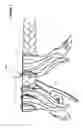 Fig. 07 - HAIR EXTENSION WEAVING DEVICE