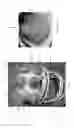 Fig. 02 - HEADGEAR PADS AND METHODS OF ATTACHMENT
