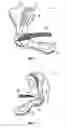 Fig. 03 - Shoe with integral orthotic/propulsion plate