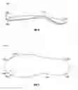 Fig. 05 - Shoe with integral orthotic/propulsion plate