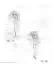 Fig. 02 - Mister equipped umbrella system