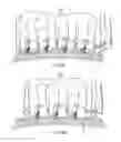 Fig. 22 - Hair coloring variegation device and method of use