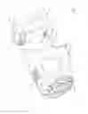 Fig. 19 - HAND CARRYABLE SURFACE CLEANING APPARATUS