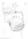 Fig. 16 - Hand carryable surface cleaning apparatus