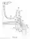 Fig. 06 - Endoscope including bending operation mechanism