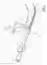 Fig. 02 - Endotracheal tube insertion device