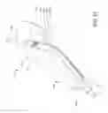 Fig. 21 - Endotracheal tube insertion device