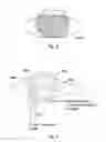Fig. 05 - Contact Lens Assessment