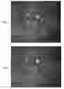 Fig. 08 - System and method for real-time montaging from live moving retina