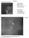 Fig. 17 - System and method for real-time montaging from live moving retina