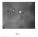 Fig. 18 - System and method for real-time montaging from live moving retina