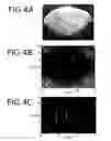 Fig. 05 - OBJECT INFORMATION ACQUIRING APPARATUS AND OBJECT INFORMATION ACQUIRING METHOD
