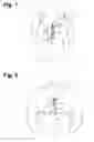 Fig. 02 - System and method for physiological data processing and delivery