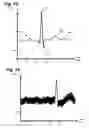 Fig. 10 - System and method for physiological data processing and delivery