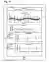 Fig. 11 - System and method for physiological data processing and delivery