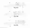 Fig. 16 - Devices, systems, and methods for removing targeted lesions from vessels