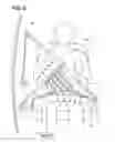 Fig. 07 - Respiratory detection device