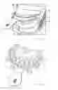 Fig. 04 - Bite tray having fiducial markers for head scan registration and method of use