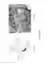 Fig. 02 - System and method for motion-free computed tomography