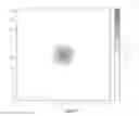 Fig. 05 - Device and method for performing nuclear imaging