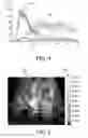 Fig. 04 - Ultrasound imaging system and method