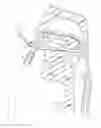 Fig. 01 - Retractor suction catheter