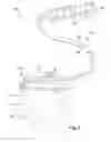 Fig. 02 - Surgical retractor for implanting leads and methods of making and using
