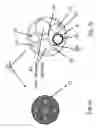 Fig. 02 - Substantially rigid and stable endoluminal surgical suite for treating a gastrointestinal lesion
